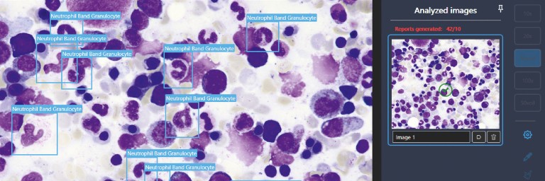 Analysiertes Bild von einem Mikroskop. Verschiedene Bereiche werden mit blauen Rahmen und Hinweisen versehen.