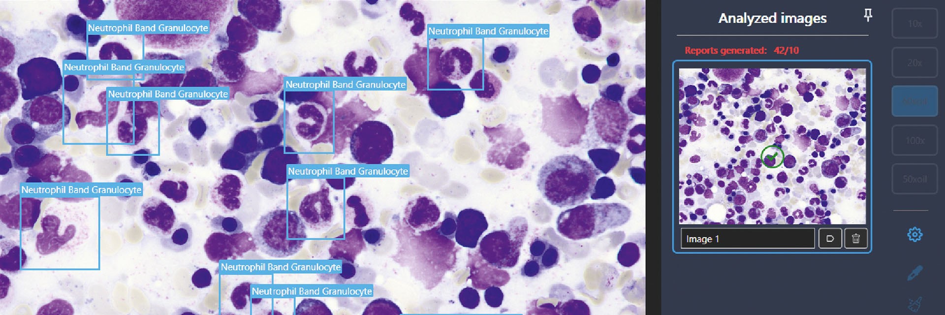 Analysiertes Bild von einem Mikroskop. Verschiedene Bereiche werden mit blauen Rahmen und Hinweisen versehen.